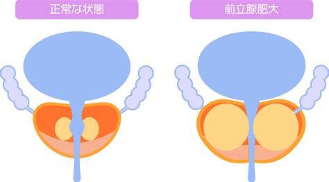 前立腺気持ちいい|前立腺と精力の関係性！そもそも前立腺って何？ – メンズ形成外。